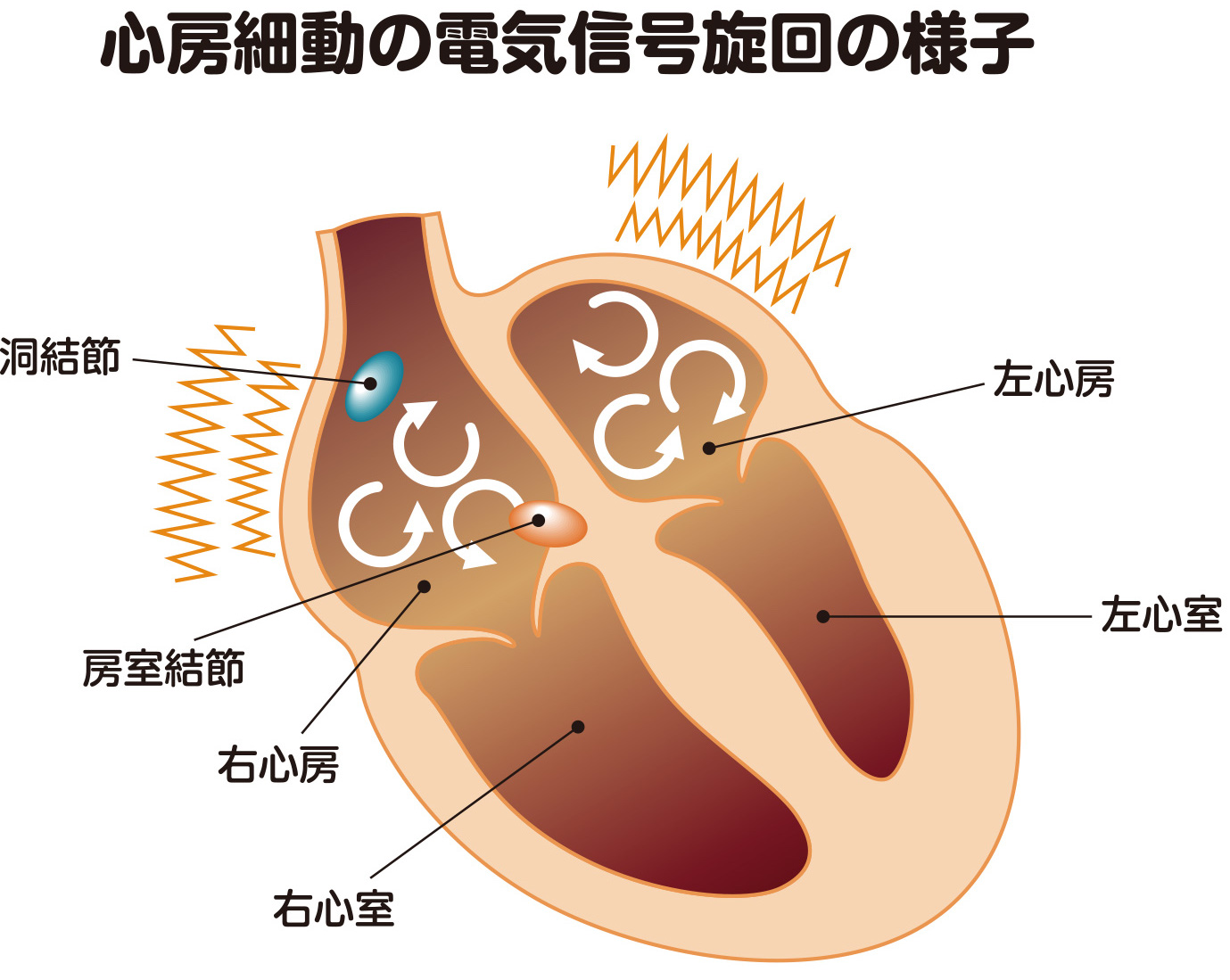 心房細動の電気信号旋回の様子